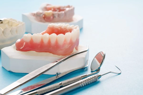 Zahnbehandlung - Optionen und Kosten im Überblick