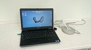 Der TRIOS-Intraoralscanner (3shape) wird mit einem Computer verbunden, der die Bilder zu einem digitalen Abdruck zusammenfügt