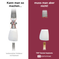 Dentaprime ermöglicht Zahnimplantat ohne Abutment