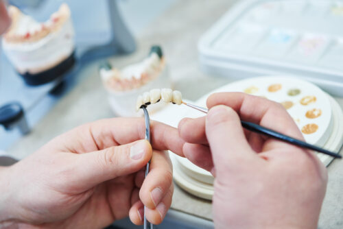 Zahntechniker Arkadi Linev erklärt: So wird individueller Zahnersatz gefertigt
