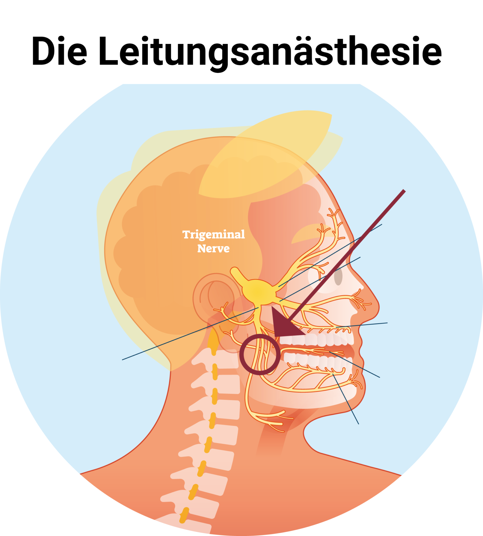 Örtliche Betäubung beim Zahnarzt – wie funktioniert das eigentlich?